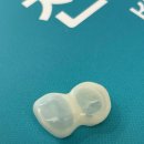 홍치과기공소 이미지