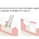 이포치과 네이버블로그