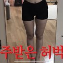 이 분 다리 지방흡입 하셨다는데 내 눈엔 전이 너무 ㄱㅊ음... 이미지