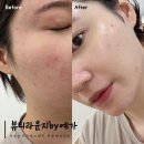 토성역1번출구 | 부산서구에스테틱 뷰티라운지by예가 문제성피부 진정관리 후기