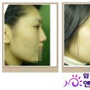 광주싸이클럽 이미지