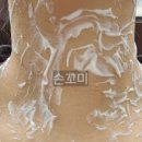 원문섭피부과의원 네이버블로그