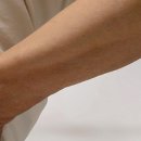 힘내라병원 네이버블로그