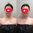 토탈코리아 | 인천 웨딩케어 포티산 프리미엄 토탈케어 리얼후기 / 인천부평 신부관리 부평 피부관리 포티산 스킨멀티...