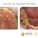 이라면 이미지