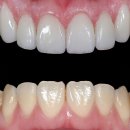 서울오브치과병원 이미지