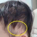 지오크리에이티브 대구경북지사 | 아기 사두증 교정 대구 지오 헬멧 6개월 착용 후기