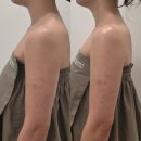 6617 | [신월] 신월동 예신 피부관리 추천 ‘비비에스테틱’ _ 다운타임 없는 기기관리, 티리온엑스 관리 후기