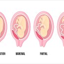 전치 앞(1) 이미지