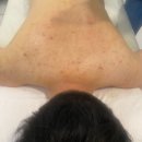 뷰티다룸천안백석점 | [뷰티] 천안등드름 관리 후기｜이정희 스킨케어에서 전체 등드름 케어