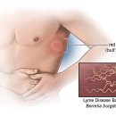 O2 테라피 이미지