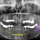 서울바른플란트치과의원 이미지