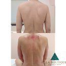 세븐충주연수중앙점 | 충주 #등관리 #뱃살 #팔뚝관리 바디슬리밍 산후관리 지방흡입후관리 #리셀핏