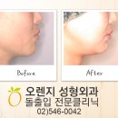 오렌지성형외과