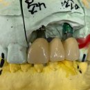 마스터치과기공소 이미지