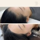 가람헤어라인