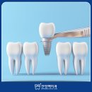 맥치과기공소 이미지