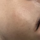 백설공주피부관리실 | 만족했던 답십리 피부관리 바나나부띠끄 백설공주케어 솔직후기