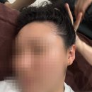 미모온 | 대구두피관리 받고 온 후기, 건성두피 관리에 좋았던 미모에스테틱 퀵스케일링