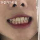 효창치과의원 네이버블로그
