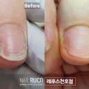 네일루카 &레푸스 네이버블로그