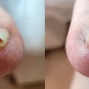 레푸스 화정점 이미지