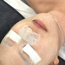 모공세척테라피