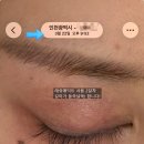 낙타속눈썹 | 래쉬애딕트 낙타영양제 찐 길어지는 속눈썹 영양제 2개월 / 5개월 리얼 후기 (광고, 협찬 X)