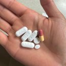 신경주요양병원 | 30대 눈쪽 얼굴 대상포진 초기증상... 경과 기록과 피부과 치료 후기