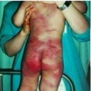 현대어린이집 이미지