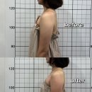 더원헬스케어 | 강북노원팔뚝살관리 더원뷰티 | 부유방+팔뚝 안녕~ | 예신관리추천