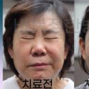 삼남빌딩(이준호한의원) | 안면신경마비 원인/ 종류/후유증/한의원 치료방법