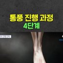 통풍가지고 계신분들 보시길… 이미지