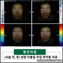 양귀비한의원 네이버블로그