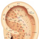 이혈 테라피 이미지