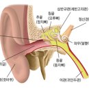 스타키보청기 종로센터 이미지