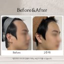오케이헤어라인