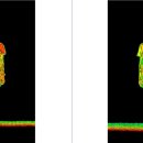 우리들척추운동센터 이미지