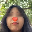 루비 | [시술후기] 압구정 루나의원 루비레이저 후기