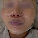 지동주민센터 | 부산 사직동모공관리 올가드림뷰티 모공디톡스 1회 후기