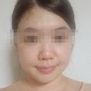 아리유 | 리뷰]피부진정팩, 피부과 전용 마스크 팩으로 사용하기 좋은 아리유 레이저닉 마스크팩 실제 사용 후기