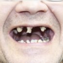 정재균치과의원 | 서울 도봉구 임플란트 가격 잘하는 곳 치과 추천 알아보기