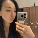 리얼전 | 대전 피부과 리쥬란 2cc 받고 왔어요! 결혼 전 피부관리 리얼 후기