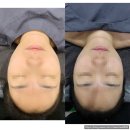 아이뷰뷰 | 김제 두피케어 뷰뷰티 / 얼굴리프팅관리까지 일석이조 토탈뷰티샵 추천