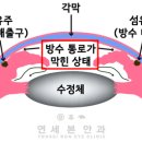 자기 전 스마트폰하면 눈 박살나는 이유 이미지