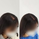 헤드샷모이스 | [판교 두피문신] 여자가르마 SMP 2회차 후기 ‘헤드샷모이스&모이스풋패디플래닝’