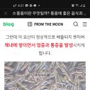 요산 이미지