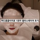 솜 글래스 | 여드름파인흉터치료 셀라스레이저 쥬베룩 피부과전문의 가격 후기