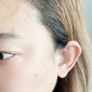 올메디 | 건조 트러블 올라 올 때 쓰기 좋았던 바이오폭스 메디프레스 리페어 크림 후기