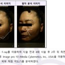 HM메디칼 | 🧲 자석 리프팅, 코어페이셜의 진짜 효과는?